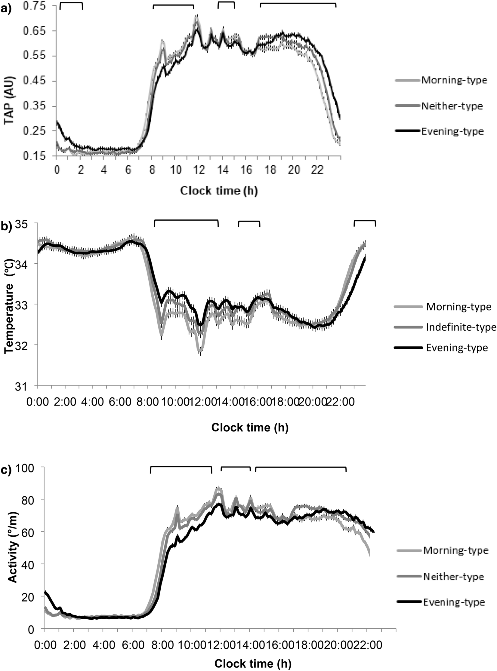 Social jetlag' and irregular sleep patterns linked to gut health