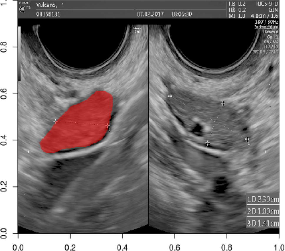 onus free dicom viewer onus free dicom viewer