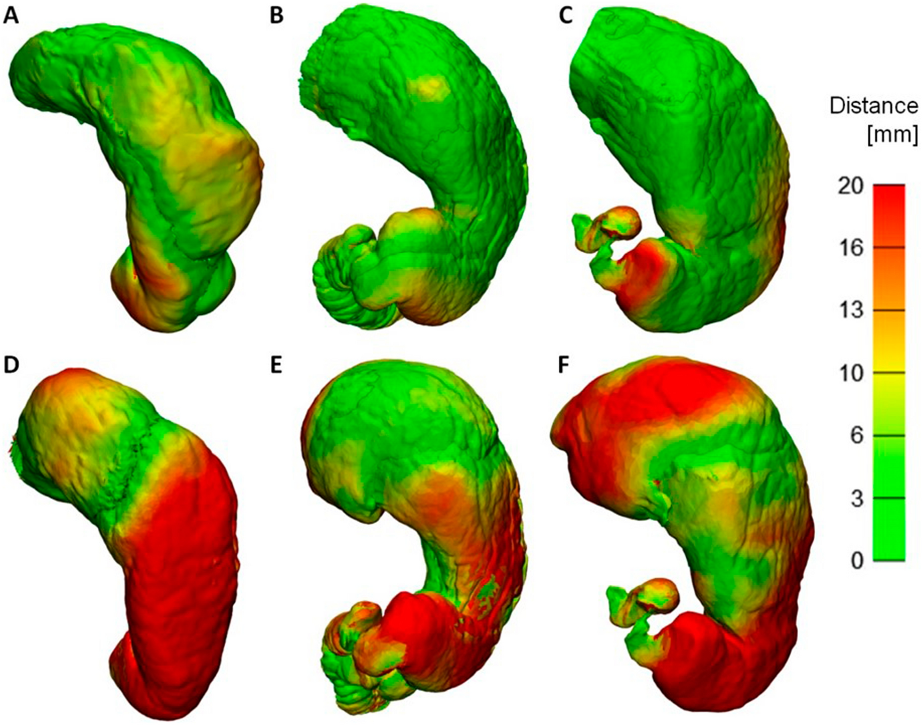 Modelling and manufacturing of 3D-printed, patient-specific, and  anthropomorphic gastric phantoms: a pilot study | Scientific Reports