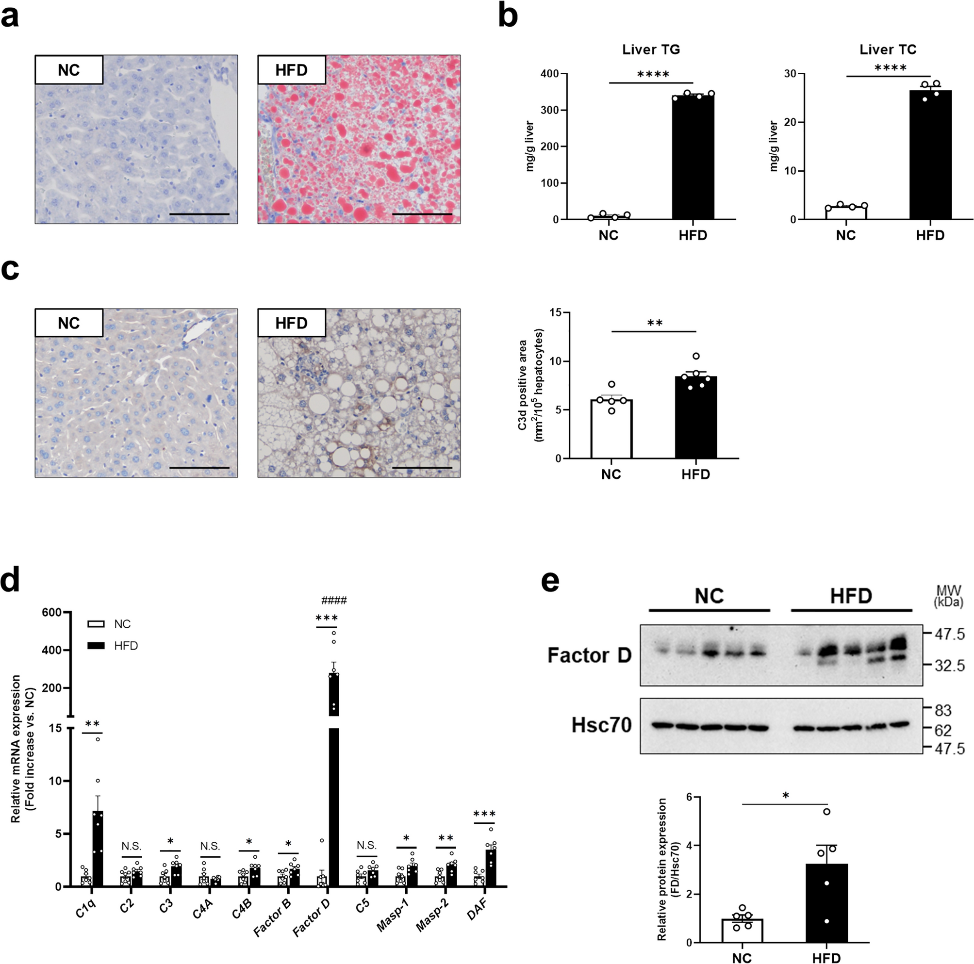 Hfd Induced Hepatic Lipid Accumulation And Inflammation Are Decreased In Factor D Deficient Mouse Scientific Reports
