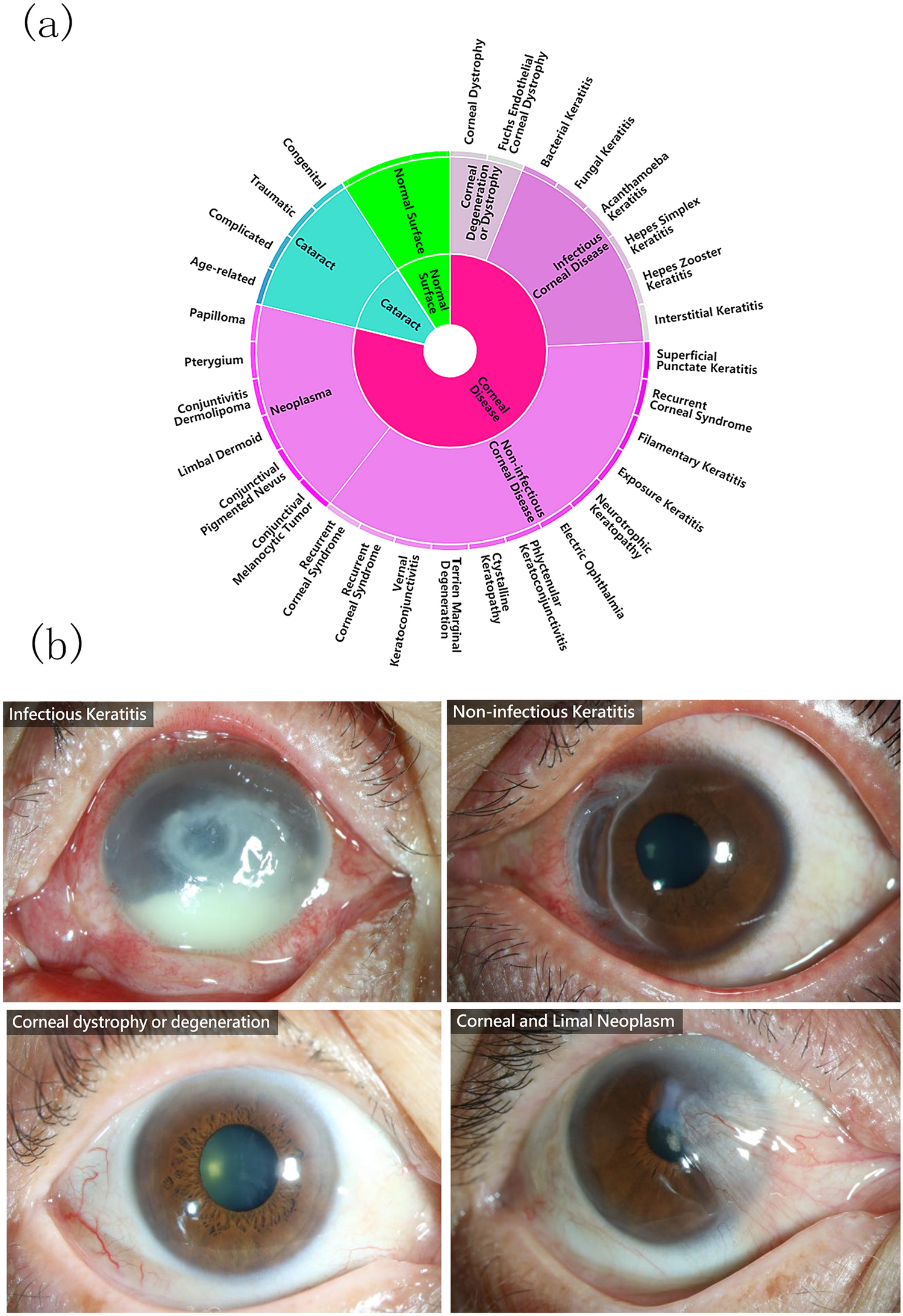 Deep learning for identifying corneal diseases from ocular surface slit-lamp  photographs | Scientific Reports