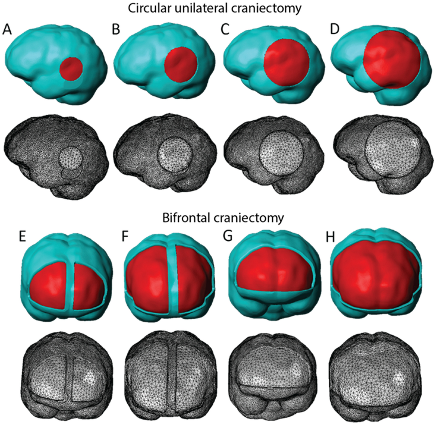 Areas of the Brain Affected by Traumatic Injury - Right - Female