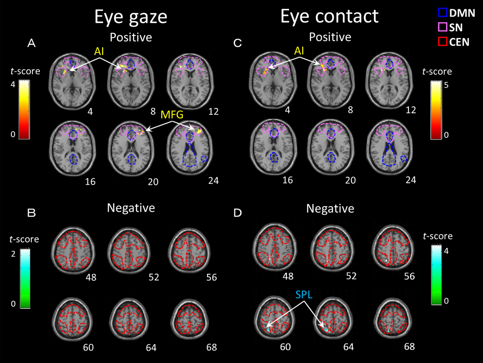 Brain Matter Craft Eyes by the Pair