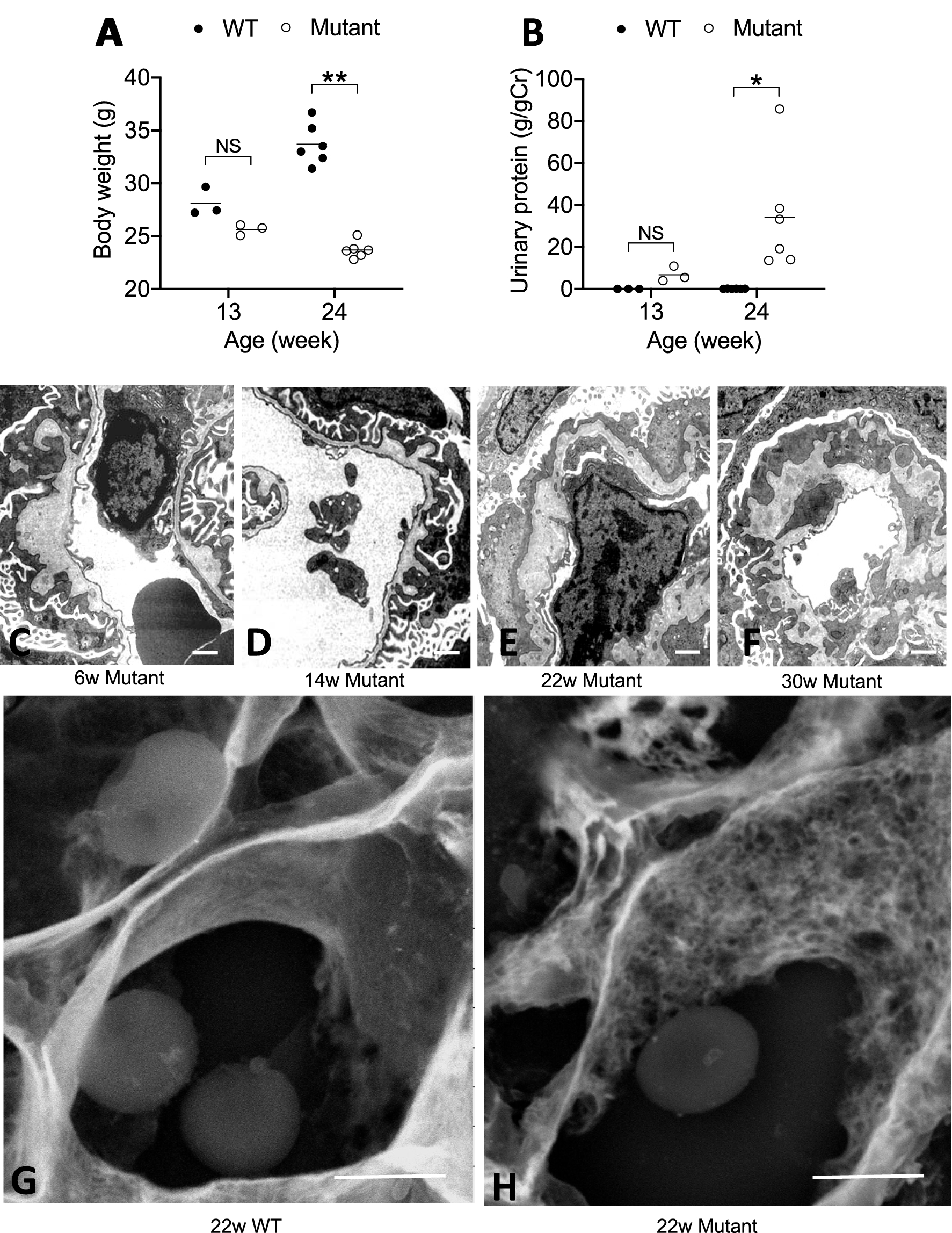 Bidirectional, non-necrotizing glomerular crescents are the critical  pathology in X-linked Alport syndrome mouse model harboring nonsense  mutation of human COL4A5 | Scientific Reports