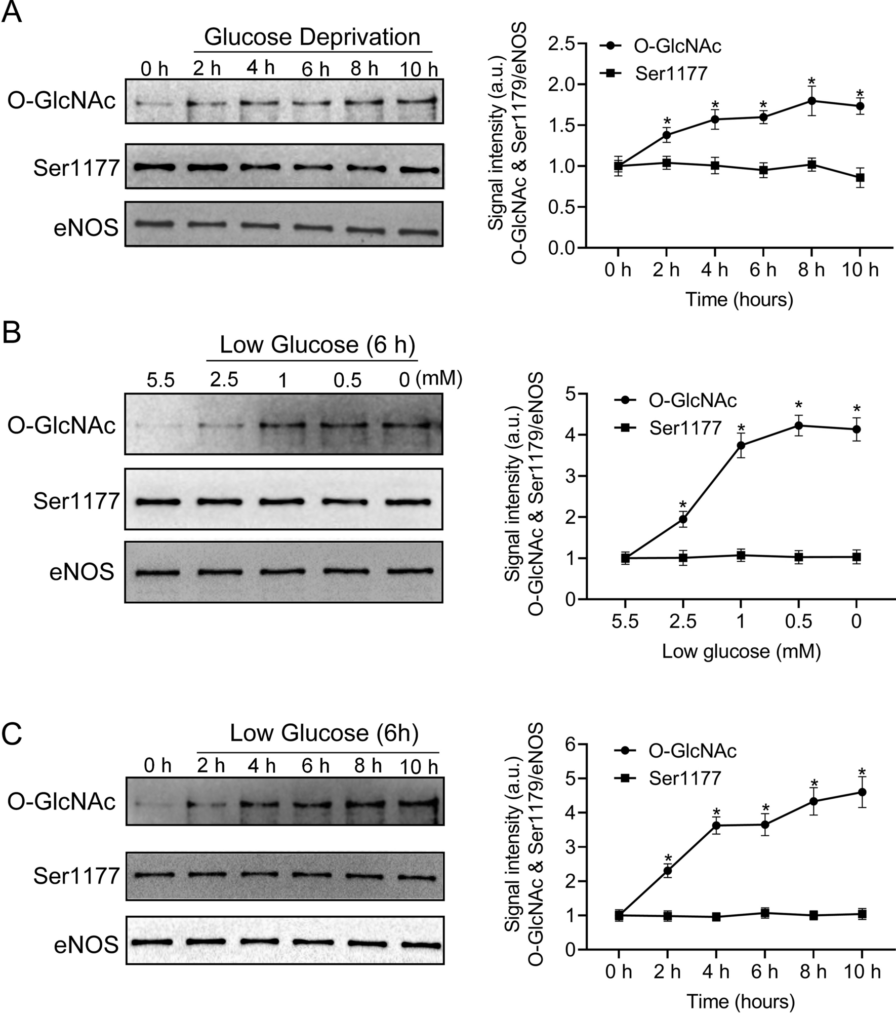 Regulation of O-GlcNAcylation on endothelial nitric oxide synthase by  glucose deprivation and identification of its O-GlcNAcylation sites |  Scientific Reports