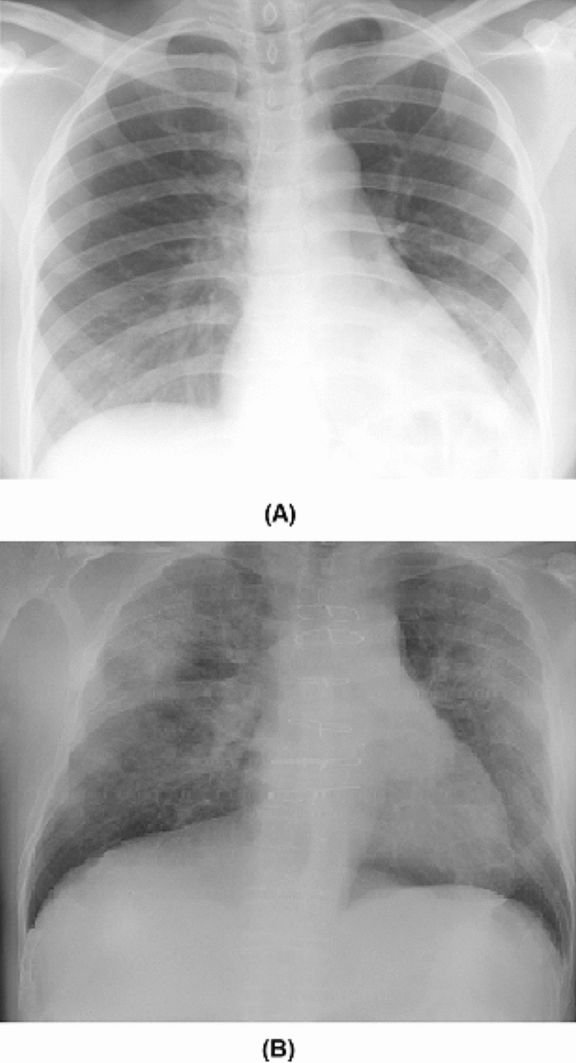 DigDig.IO X-Ray