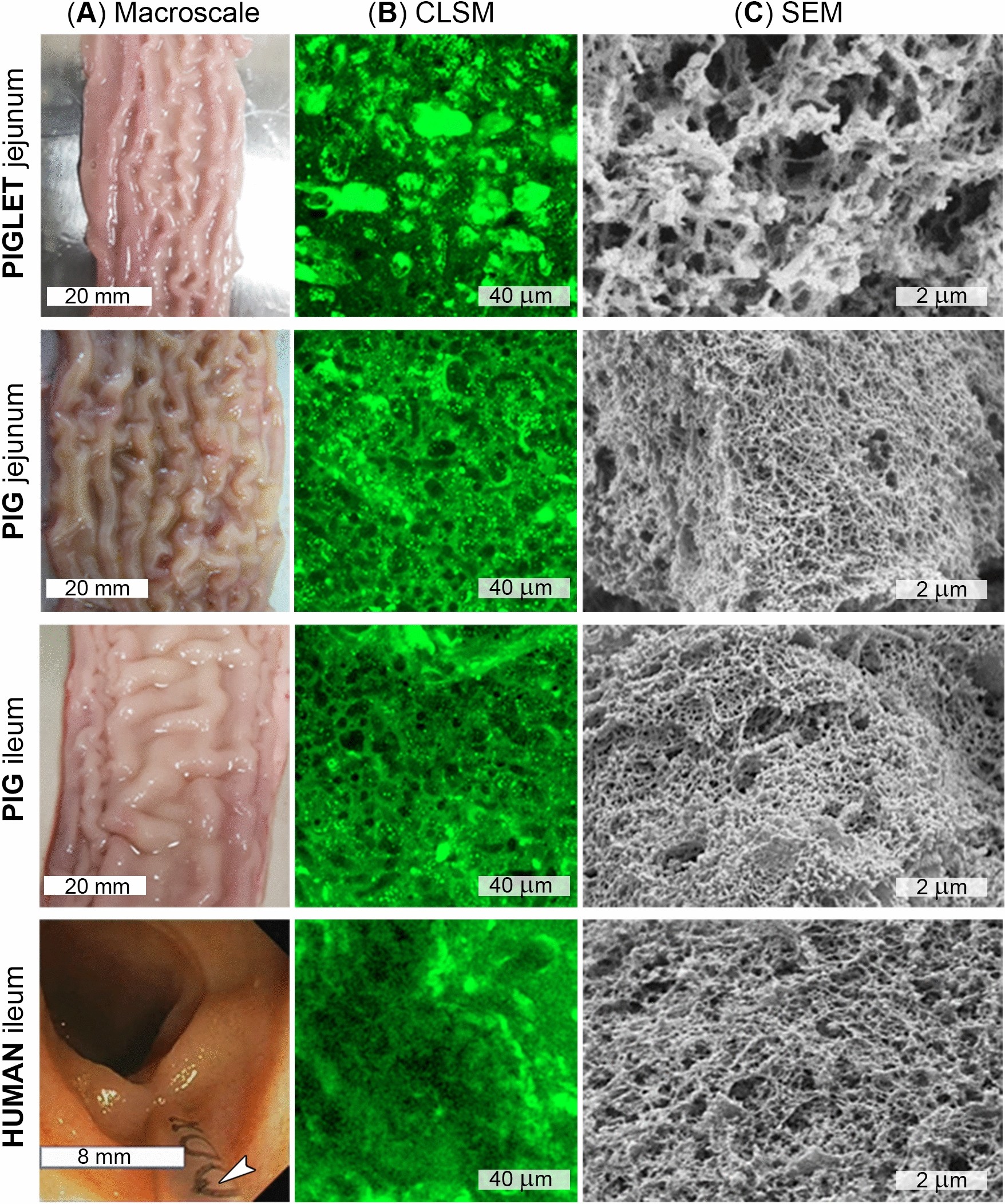 The Microscopic Structures of Dried Human Tears, Science