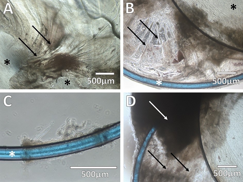 Long-term myofibroblast persistence in the capsular bag contributes to the  late spontaneous in-the-bag intraocular lens dislocation | Scientific  Reports