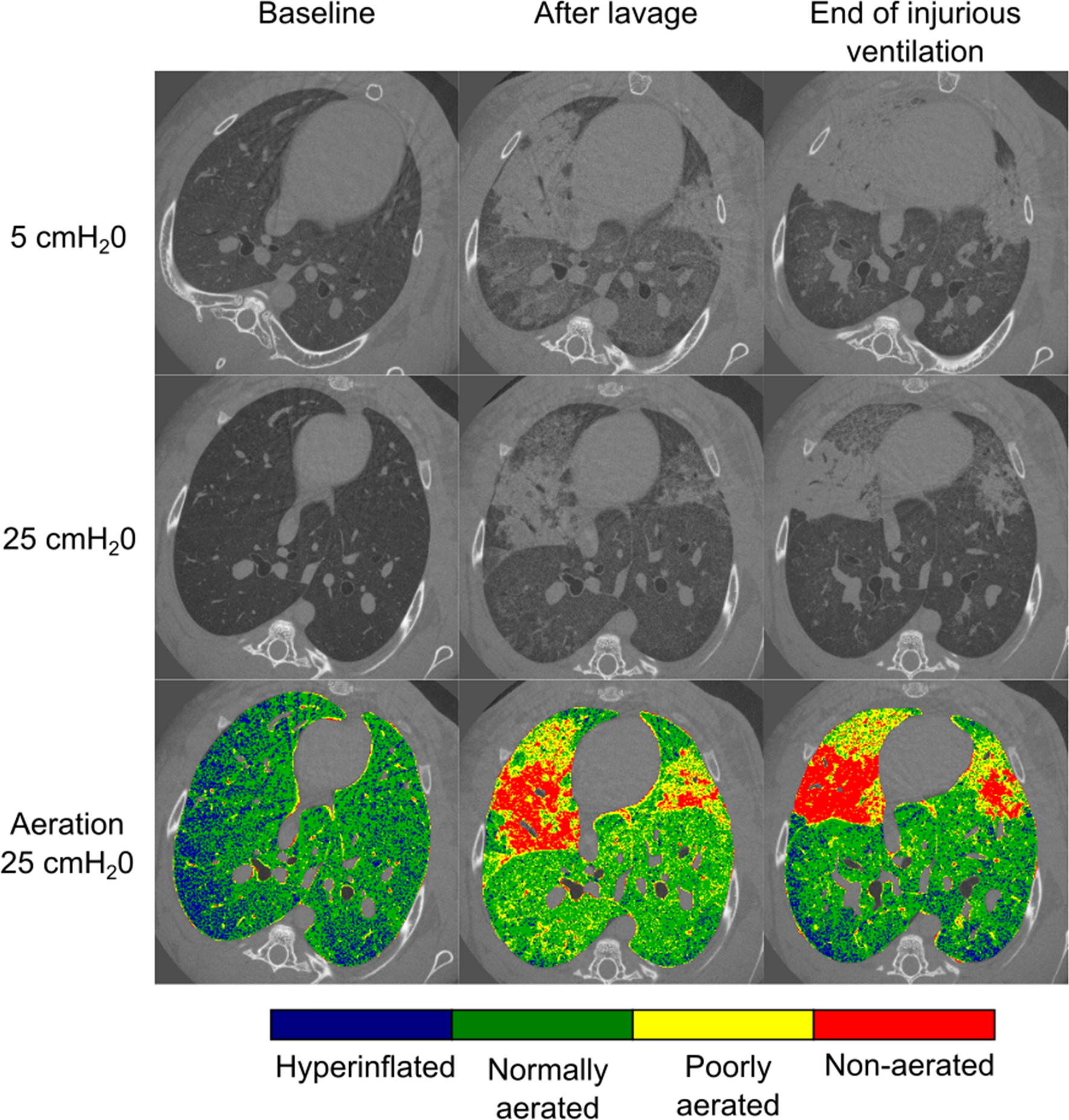 Imaging atelectrauma in Ventilator-Induced Lung Injury using 4D X-ray  microscopy | Scientific Reports