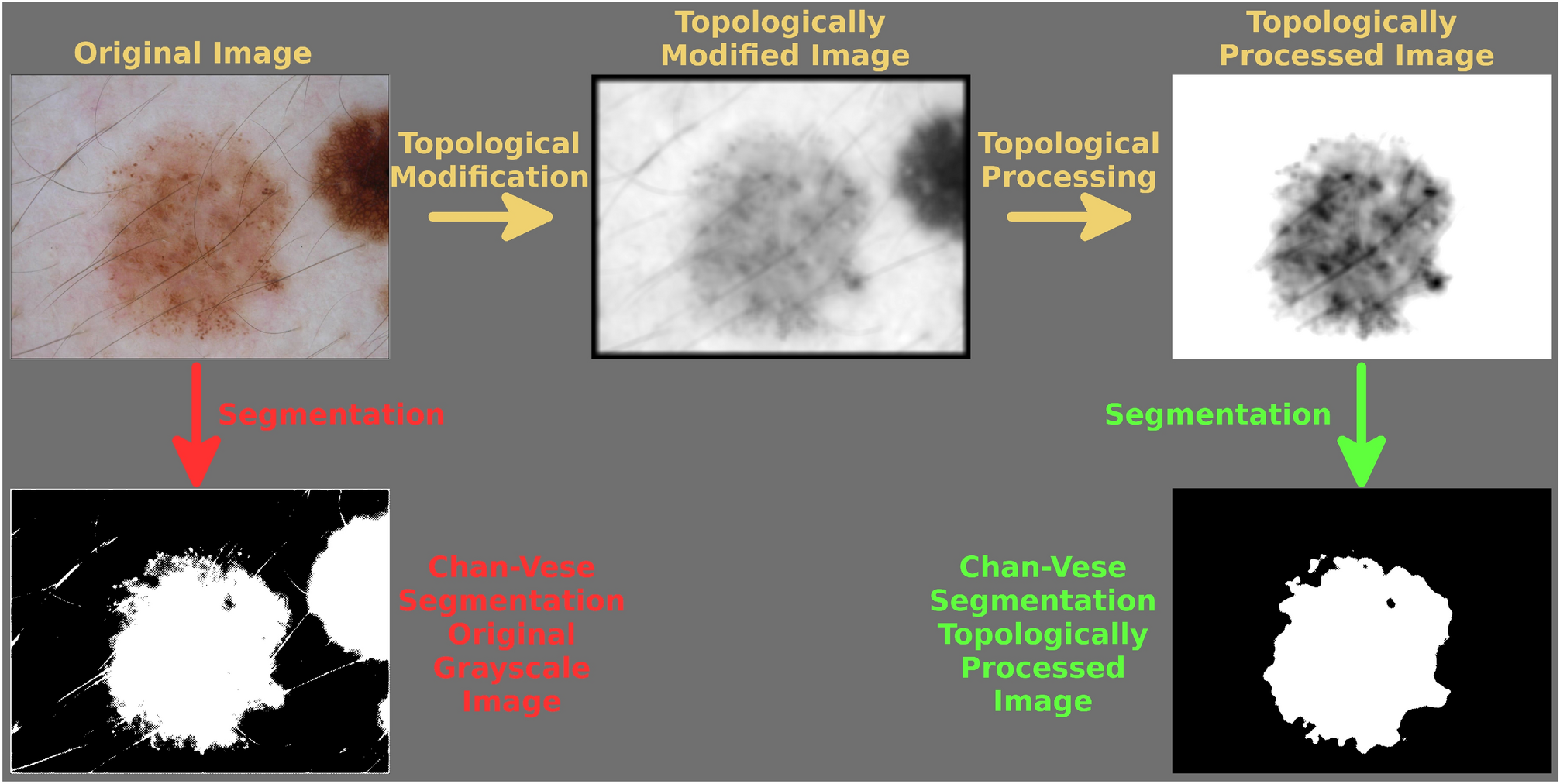 Topological image modification for object detection and topological image  processing of skin lesions | Scientific Reports
