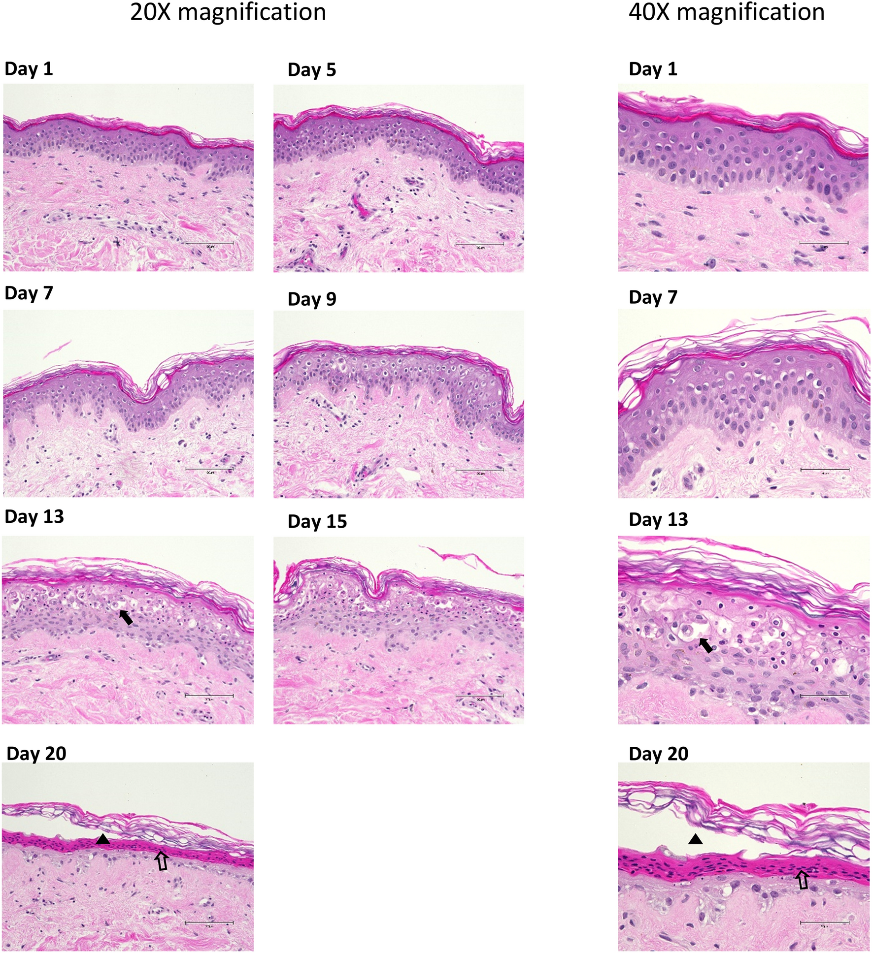 Human skin explant model for the investigation of topical therapeutics |  Scientific Reports
