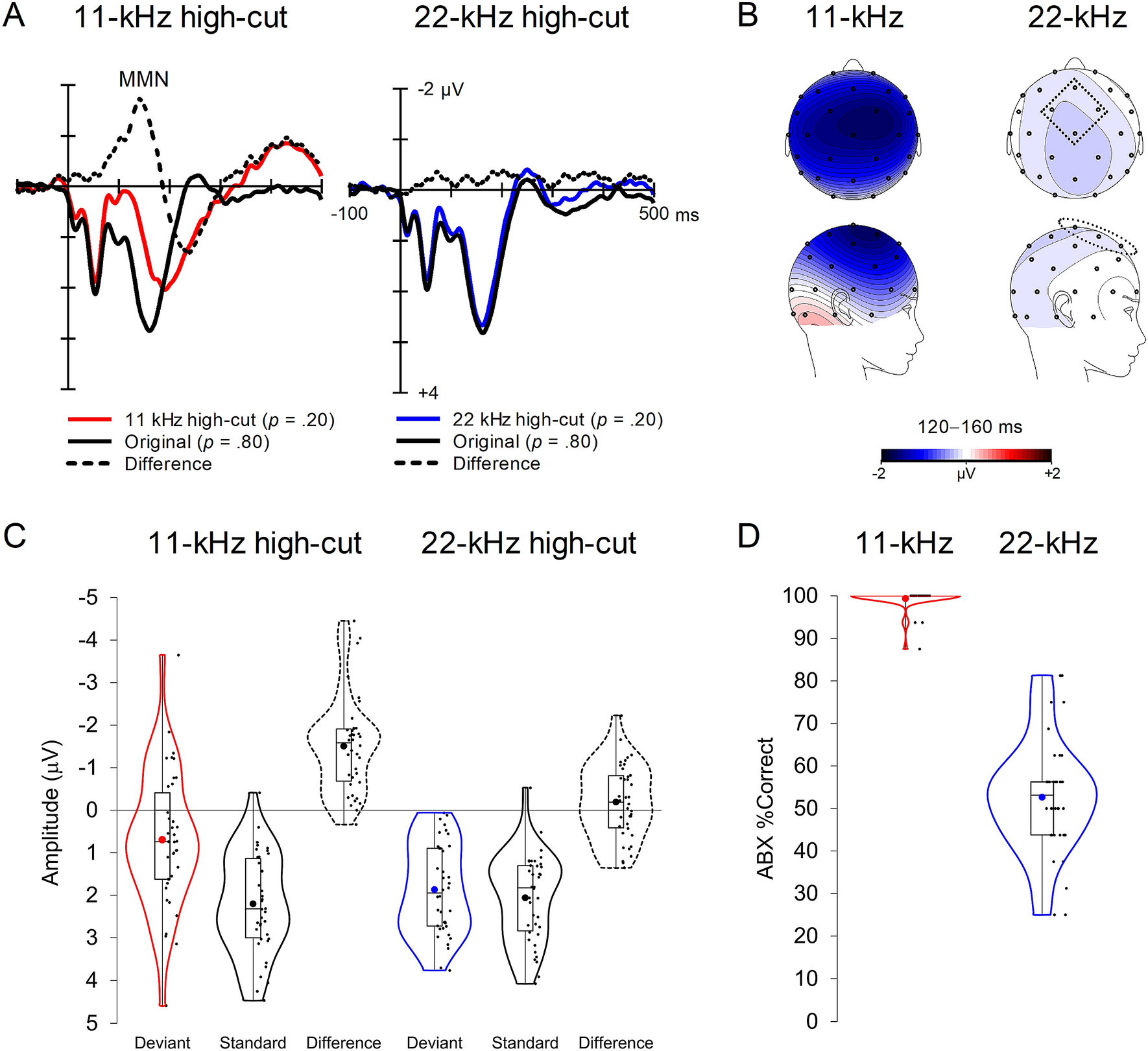 High-frequency sound components of high-resolution audio are not detected  in auditory sensory memory | Scientific Reports