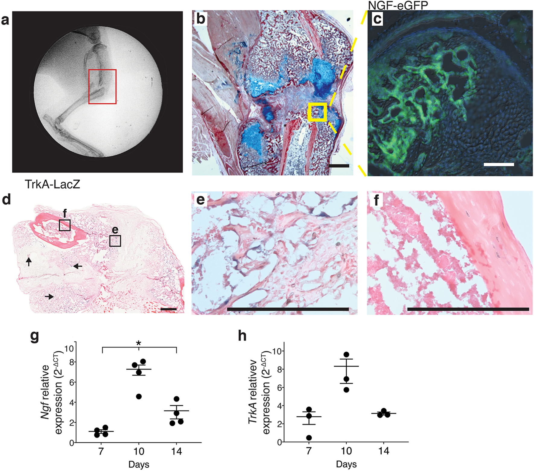 local injections of b ngf accelerates endochondral fracture repair by promoting cartilage to bone conversion scientific reports