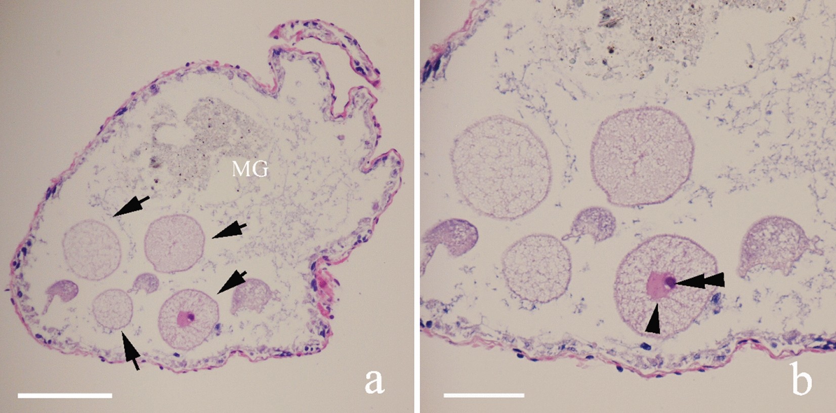 First record of gregarine protists (Apicomplexa: Sporozoa) in Asian  fungus-growing termite Macrotermes barneyi (Blattaria: Termitidae) |  Scientific Reports