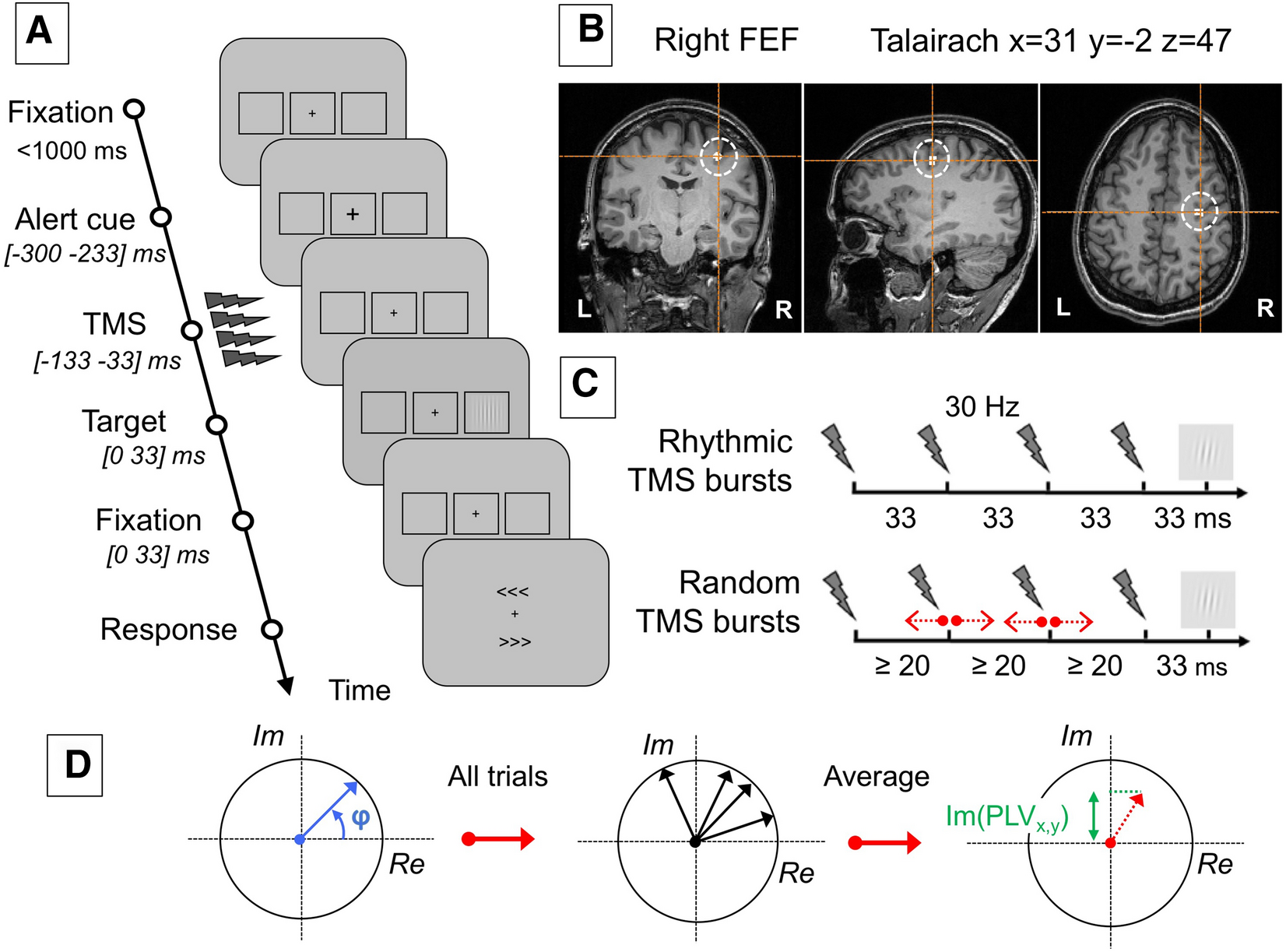 Causal Modulation Of Right Hemisphere Fronto Parietal Phase Synchrony With Transcranial Magnetic Stimulation During A Conscious Visual Detection Task Scientific Reports