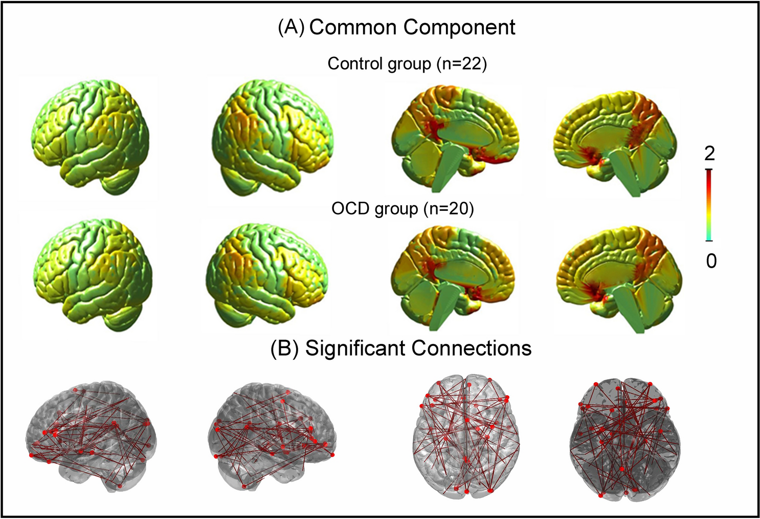 Individual-fMRI-approaches reveal cerebellum and visual communities to be  functionally connected in obsessive compulsive disorder | Scientific Reports