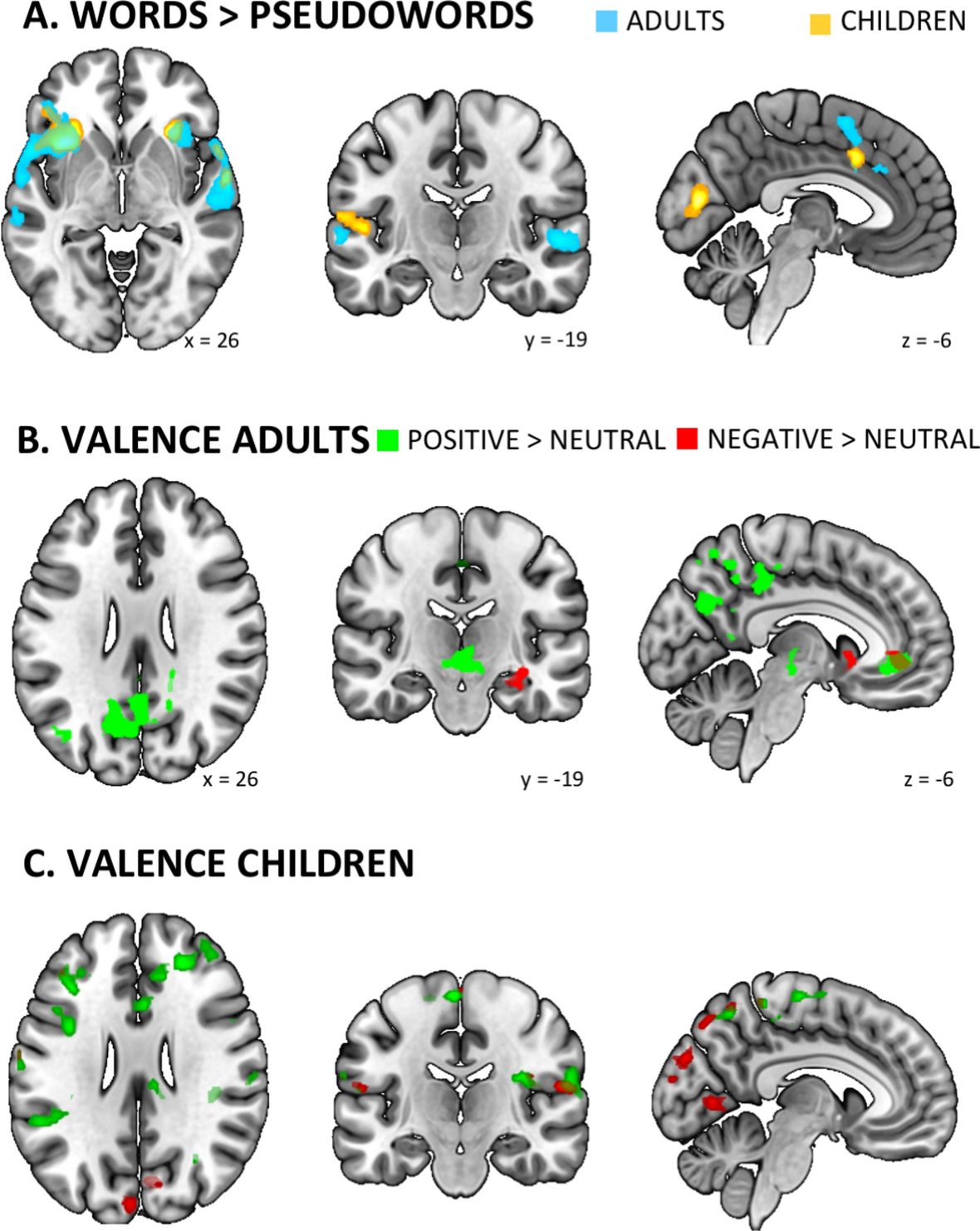 Neural correlates of affective contributions to lexical decisions in  children and adults | Scientific Reports
