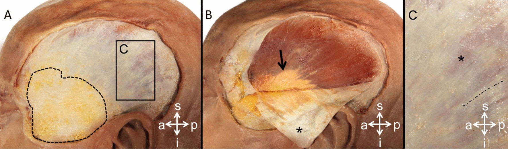 Klebe perücke männer Clearance