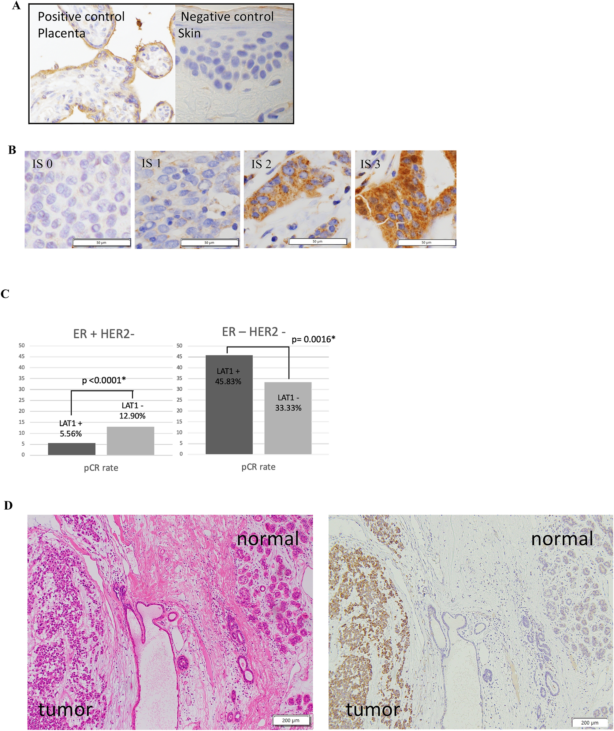 L Type Amino Acid Transporter 1 Is Associated With Chemoresistance In Breast Cancer Via The Promotion Of Amino Acid Metabolism Scientific Reports