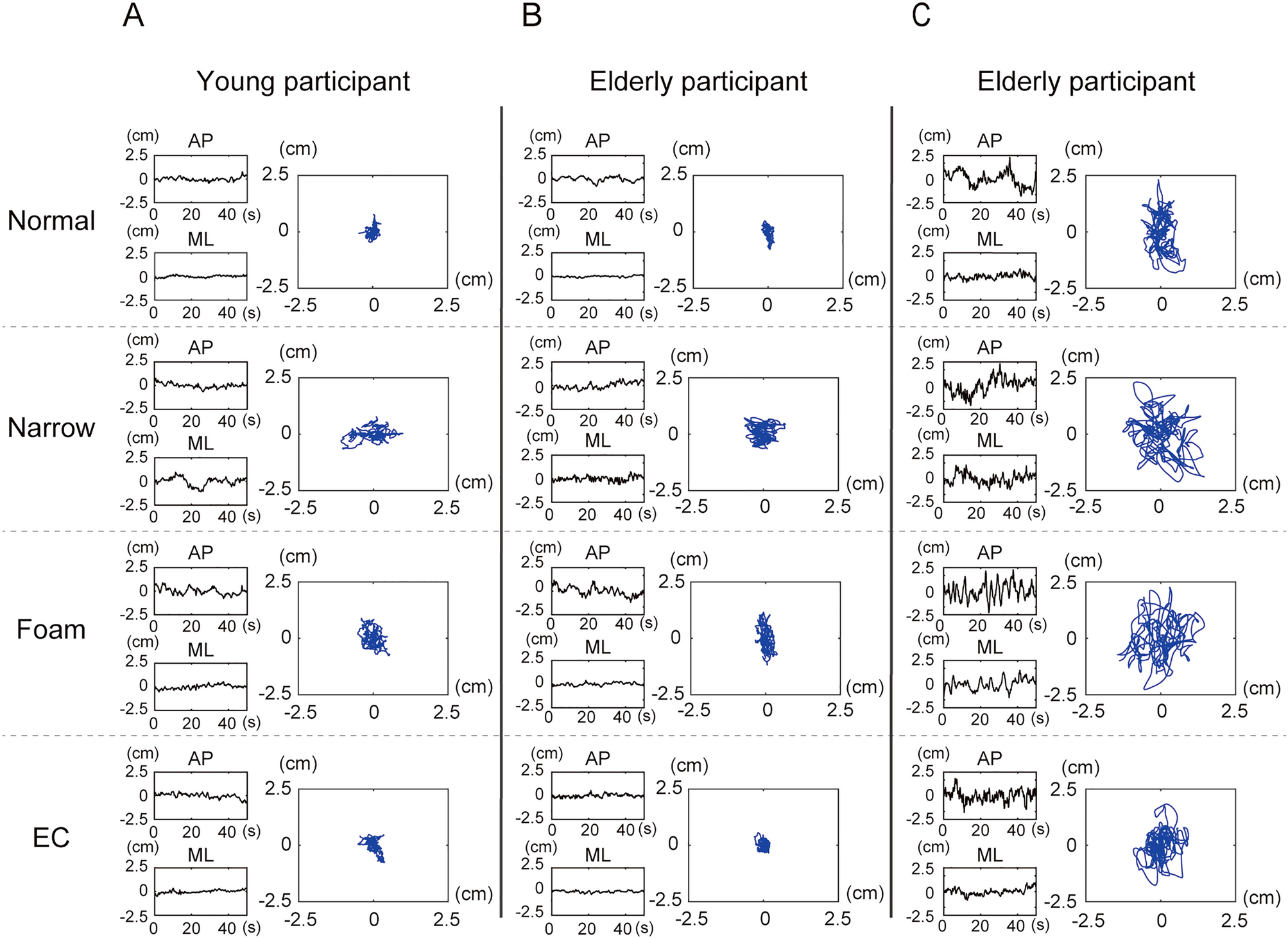 Discrimination Of Standing Postures Between Young And Elderly People Based On Center Of Pressure Scientific Reports