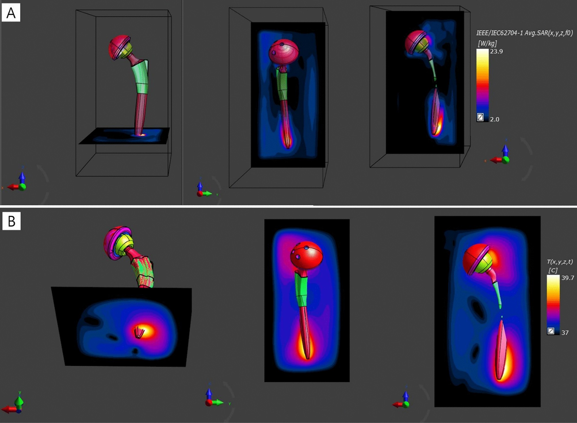 Measurement and evaluation of specific absorption rate and temperature  elevation caused by an artificial hip joint during MRI scanning |  Scientific Reports