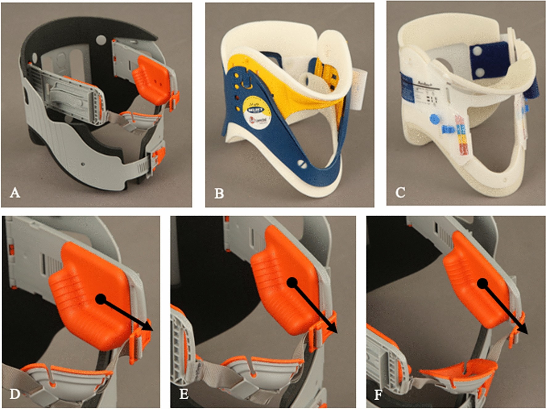 Analysis of remaining motion using one innovative upper airway