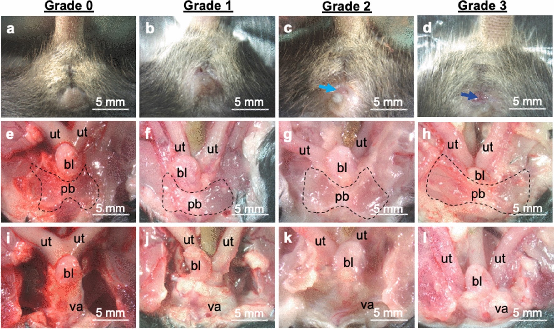 tween open vagina Role of fibulin-5 insufficiency and prolapse progression on murine vaginal  biomechanical function | Scientific Reports