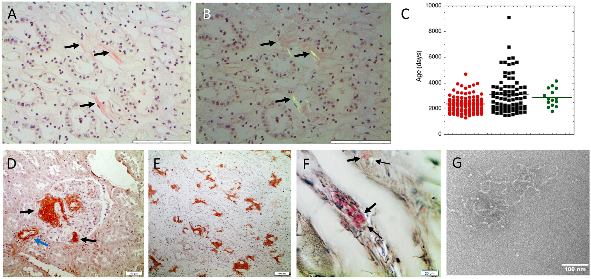 Amyloid In Human Food Chain Is A Possible Biohazard Scientific Reports