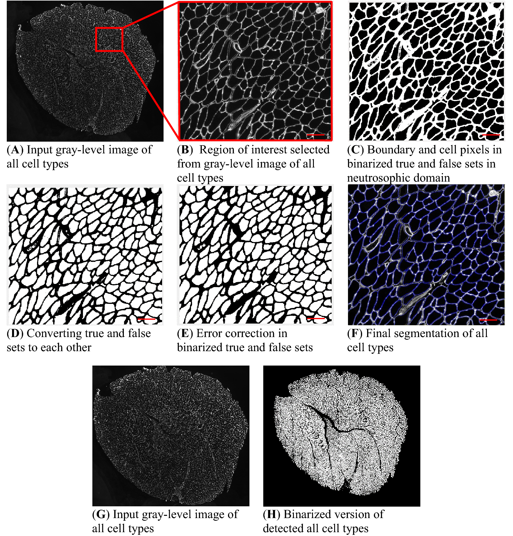 Automated Image Segmentation Method To Analyse Skeletal Muscle Cross Section In Exercise Induced Regenerating Myofibers Scientific Reports