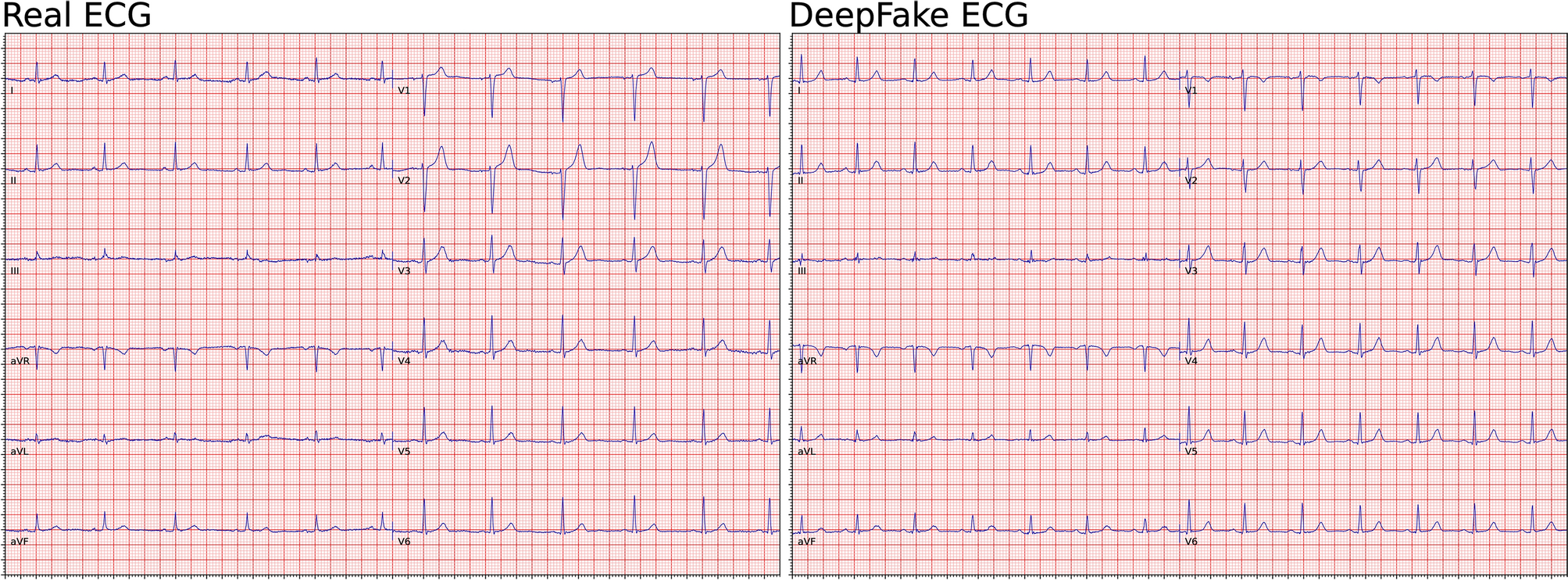 DeepFake electrocardiograms using generative adversarial are the of the for privacy issues medicine | Scientific Reports