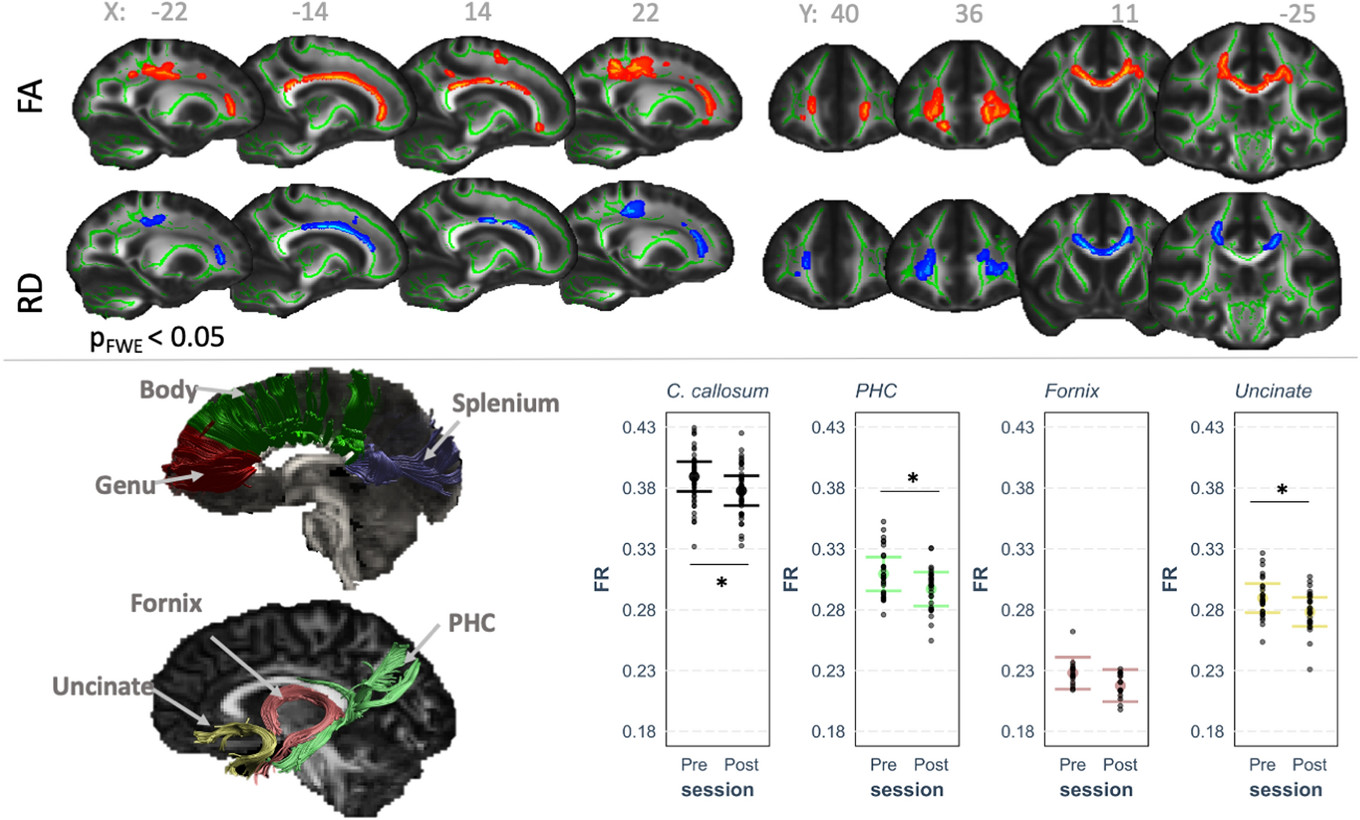 Changes in white matter microstructure and MRI-derived cerebral blood flow  after 1-week of exercise training | Scientific Reports