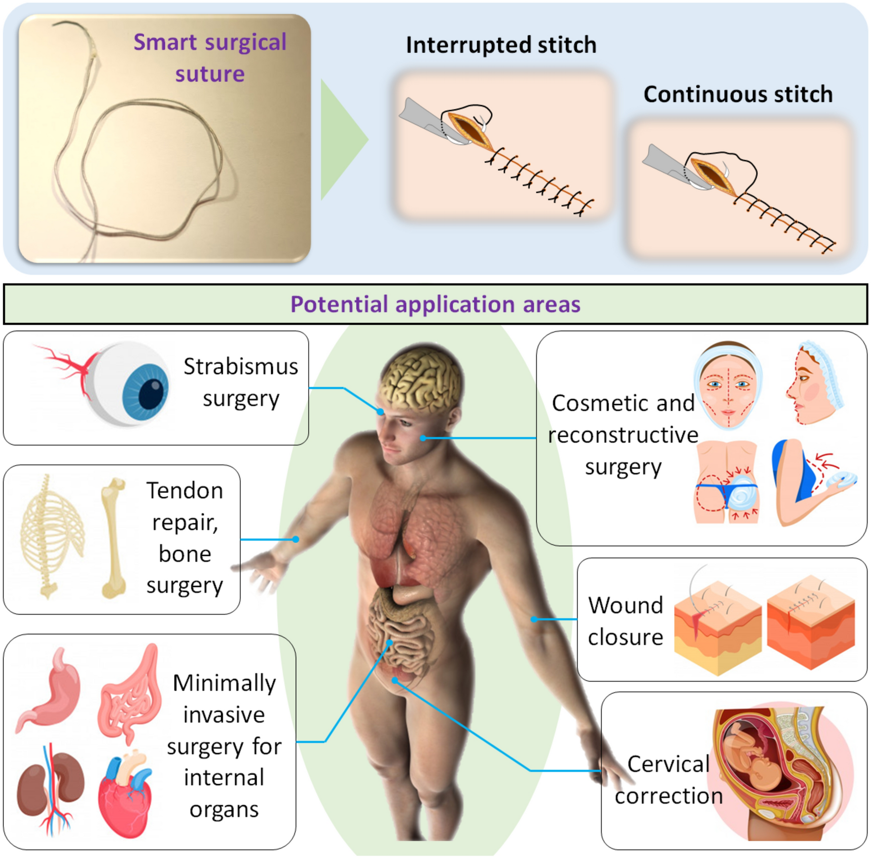 Step-by-Step Guide to Stitches (Placing & Removing Sutures)