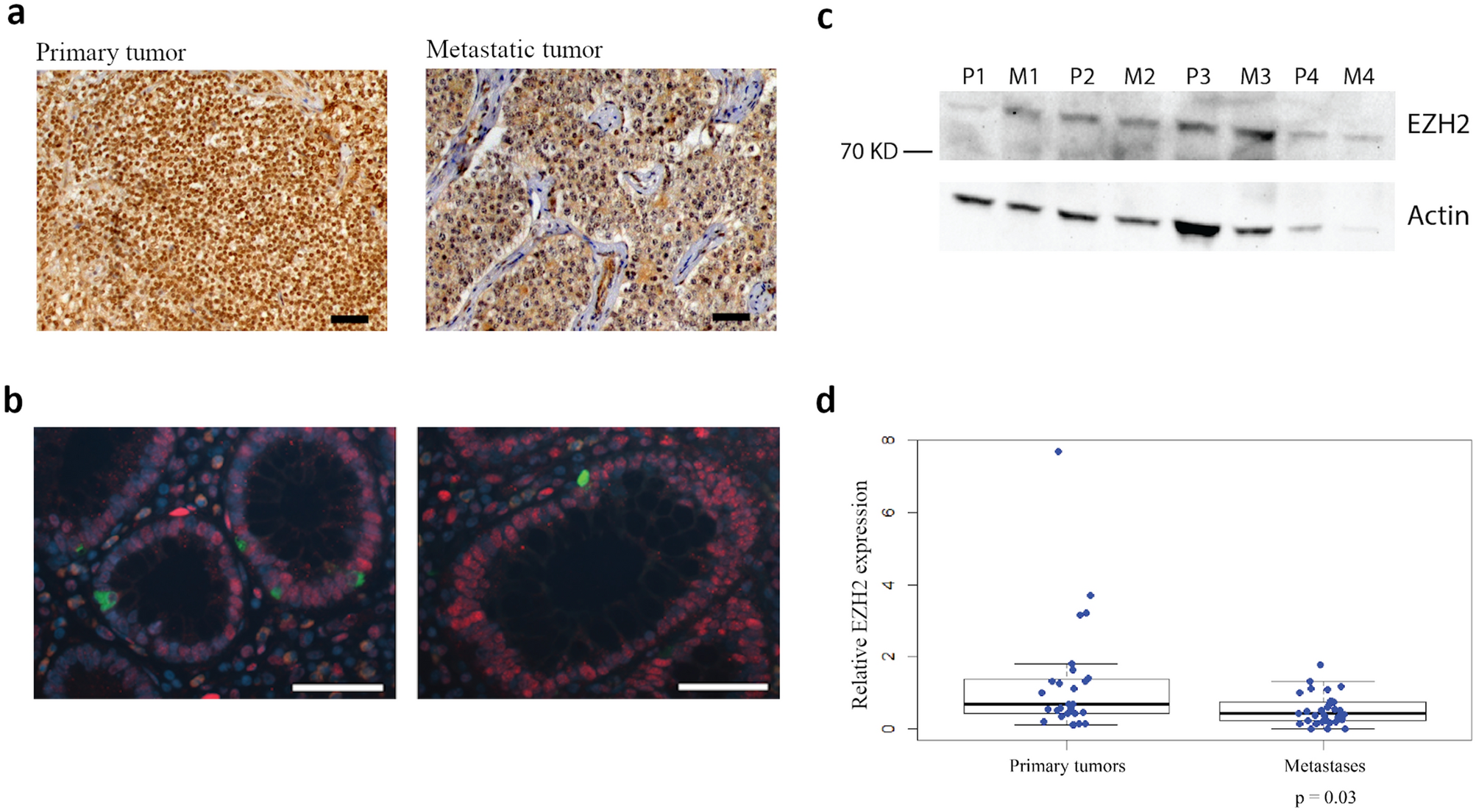 Ezh2 Presents A Therapeutic Target For Neuroendocrine Tumors Of The Small Intestine Scientific Reports
