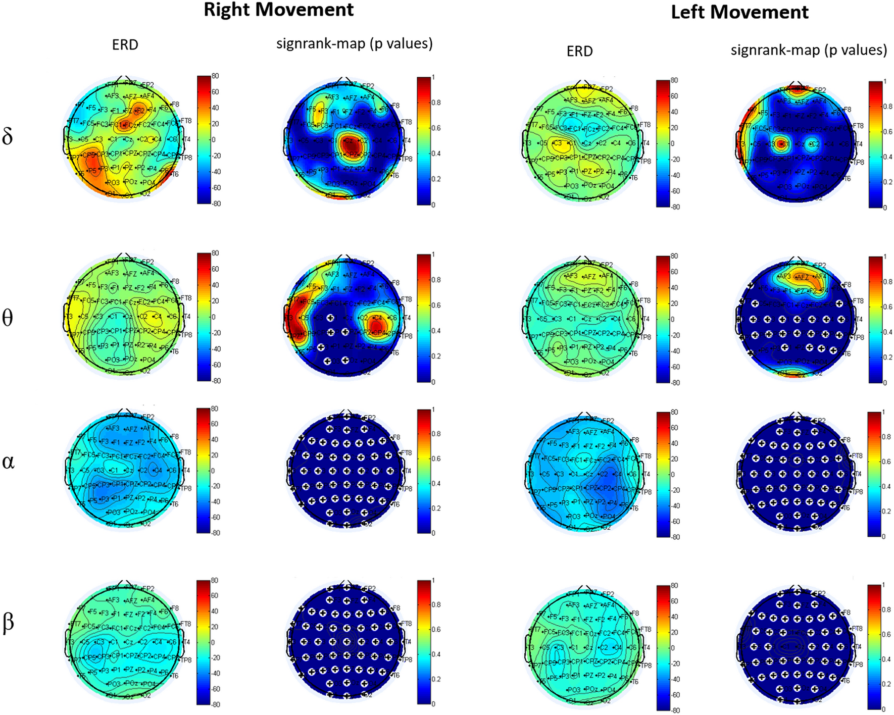 Channel spectra and map visualization of the beta band (13-30 Hz) of a