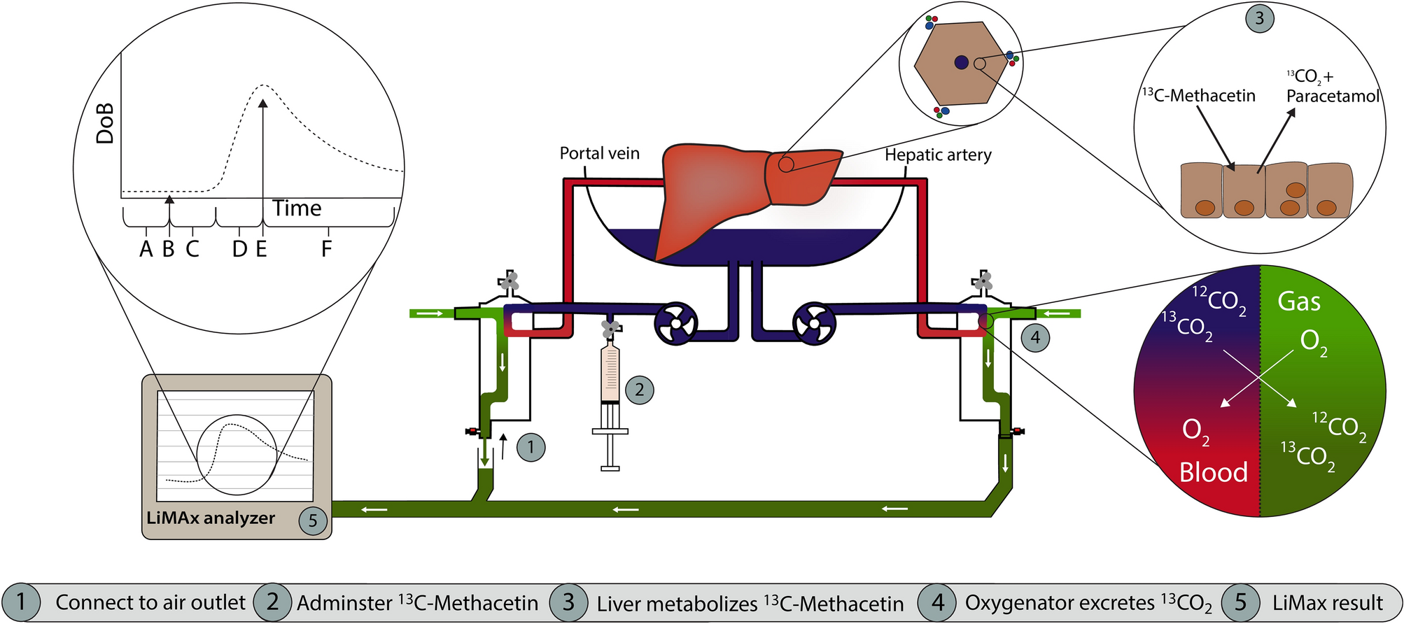 A proof of concept study on real-time LiMAx CYP1A2 liver function  assessment of donor grafts during normothermic machine perfusion |  Scientific Reports