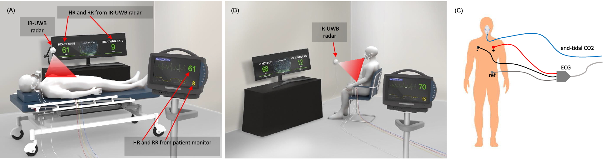 Patient Monitors, Vital Signs Monitor, EKG Monitor