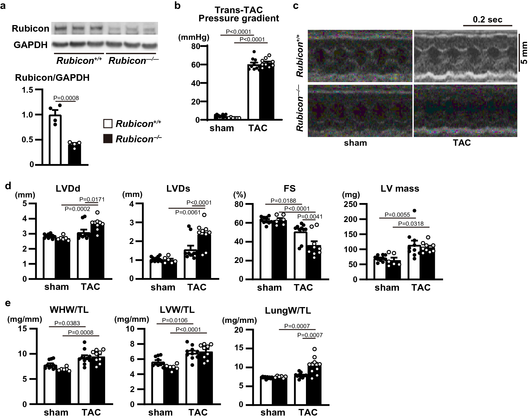 α1-and β-adrenergic antagonist labetalol induces morphological changes in  human erythrocytes - ScienceDirect