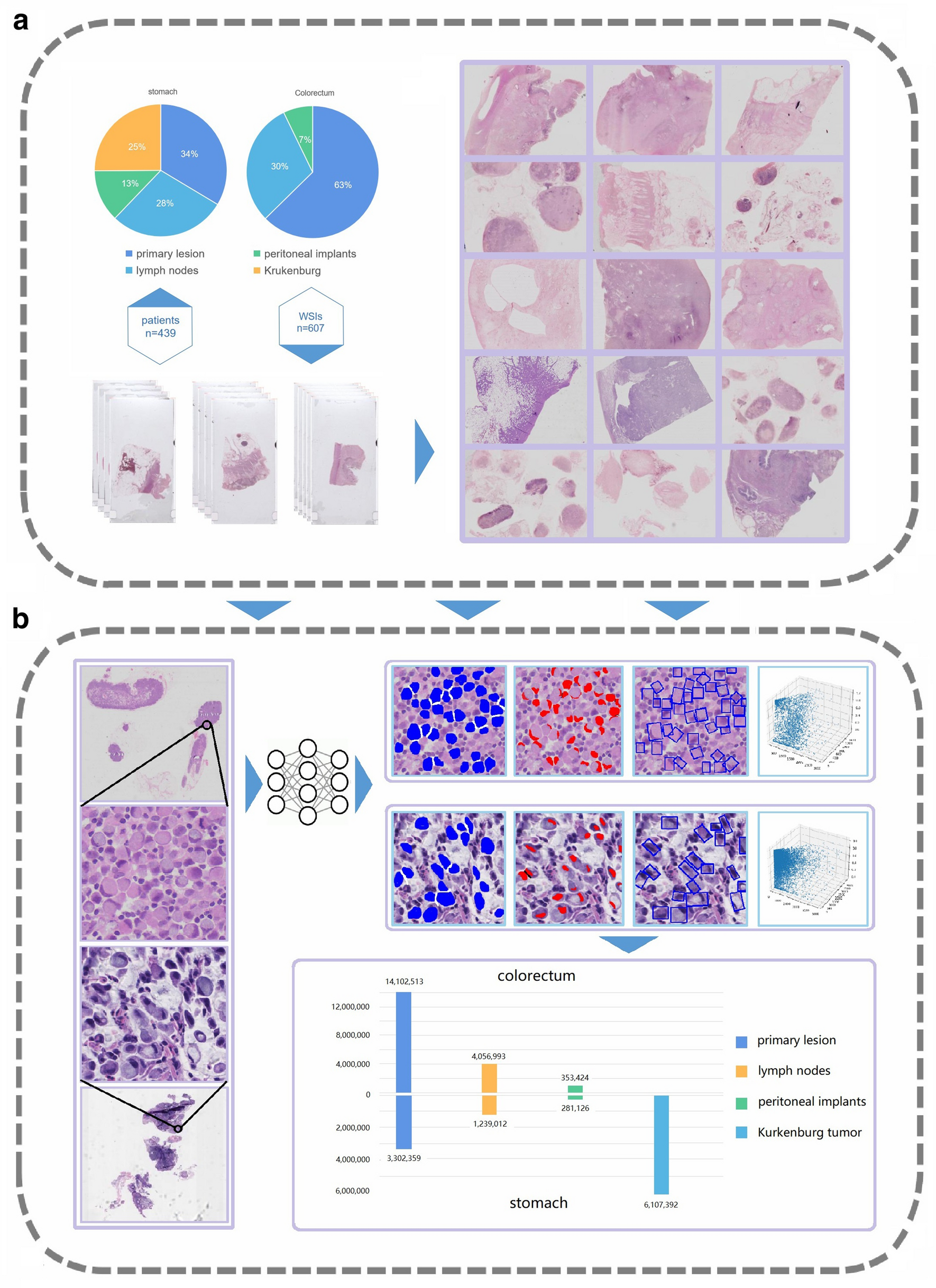 Quantifying the cell morphology and predicting biological behavior of signet  ring cell carcinoma using deep learning | Scientific Reports