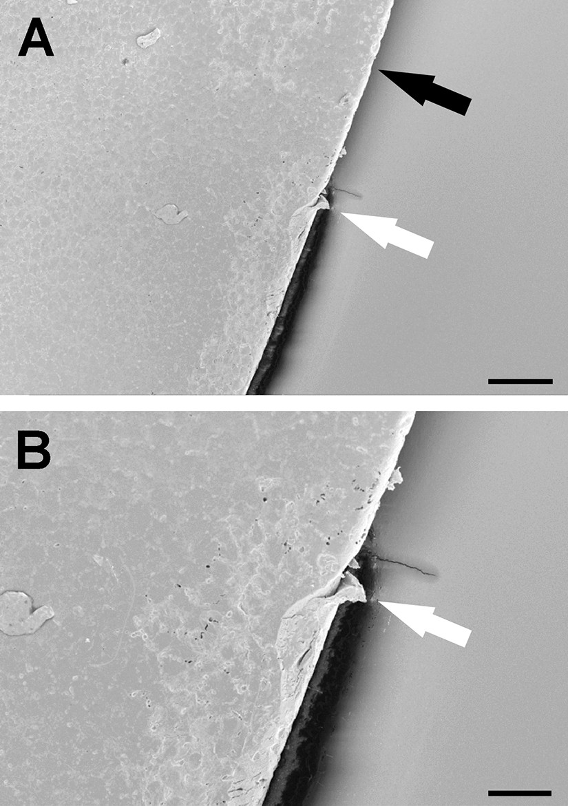 Electron microscopy analysis of femtosecond laser-assisted capsulotomy before and after lens fragmentation