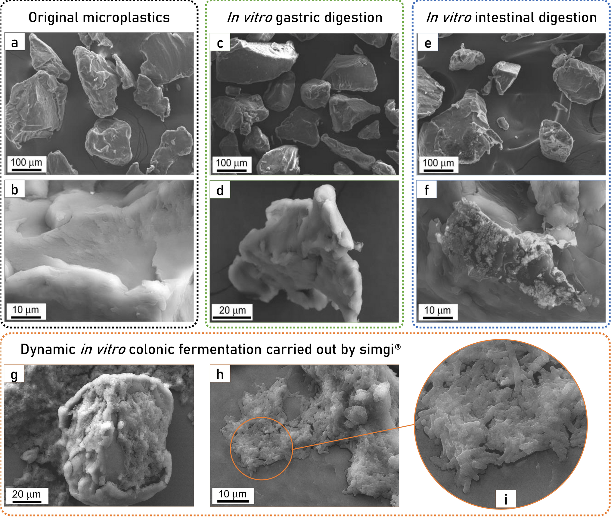 PET microplastics affect human gut microbiota communities during simulated  gastrointestinal digestion, first evidence of plausible polymer  biodegradation during human digestion | Scientific Reports
