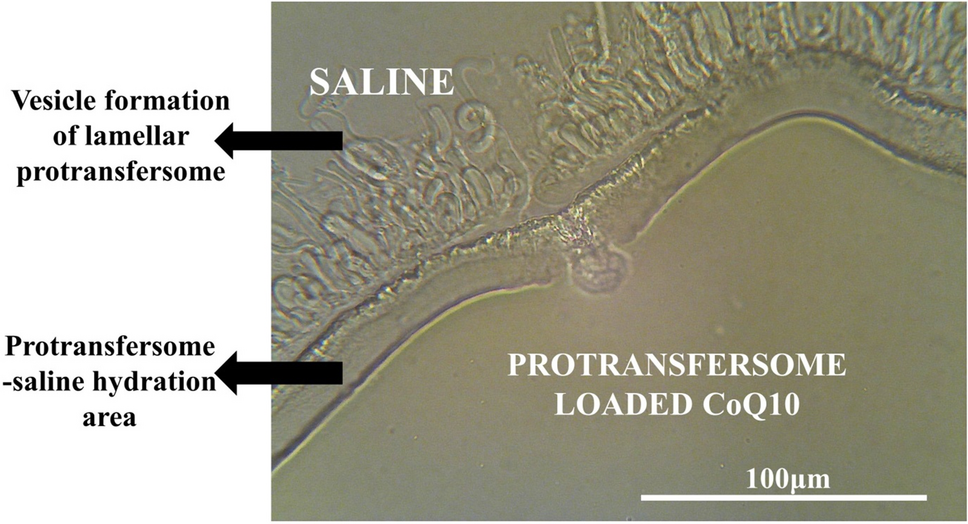 Improving the anti-ageing activity of coenzyme Q10 through protransfersome-loaded emulgel | Scientific Reports Improving the anti-ageing activity of coenzyme Q10 through protransfersome-loaded emulgel | Scientific Reports