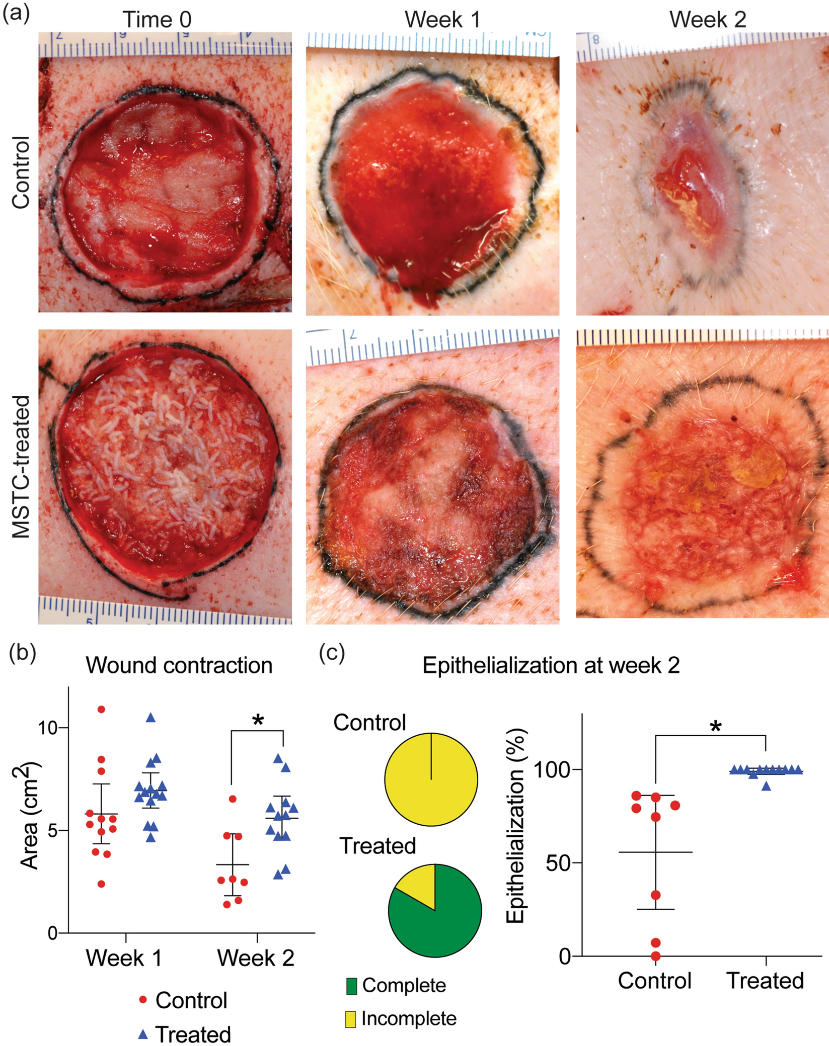 Multi-faceted enhancement of full-thickness skin wound healing by treatment  with autologous micro skin tissue columns | Scientific Reports