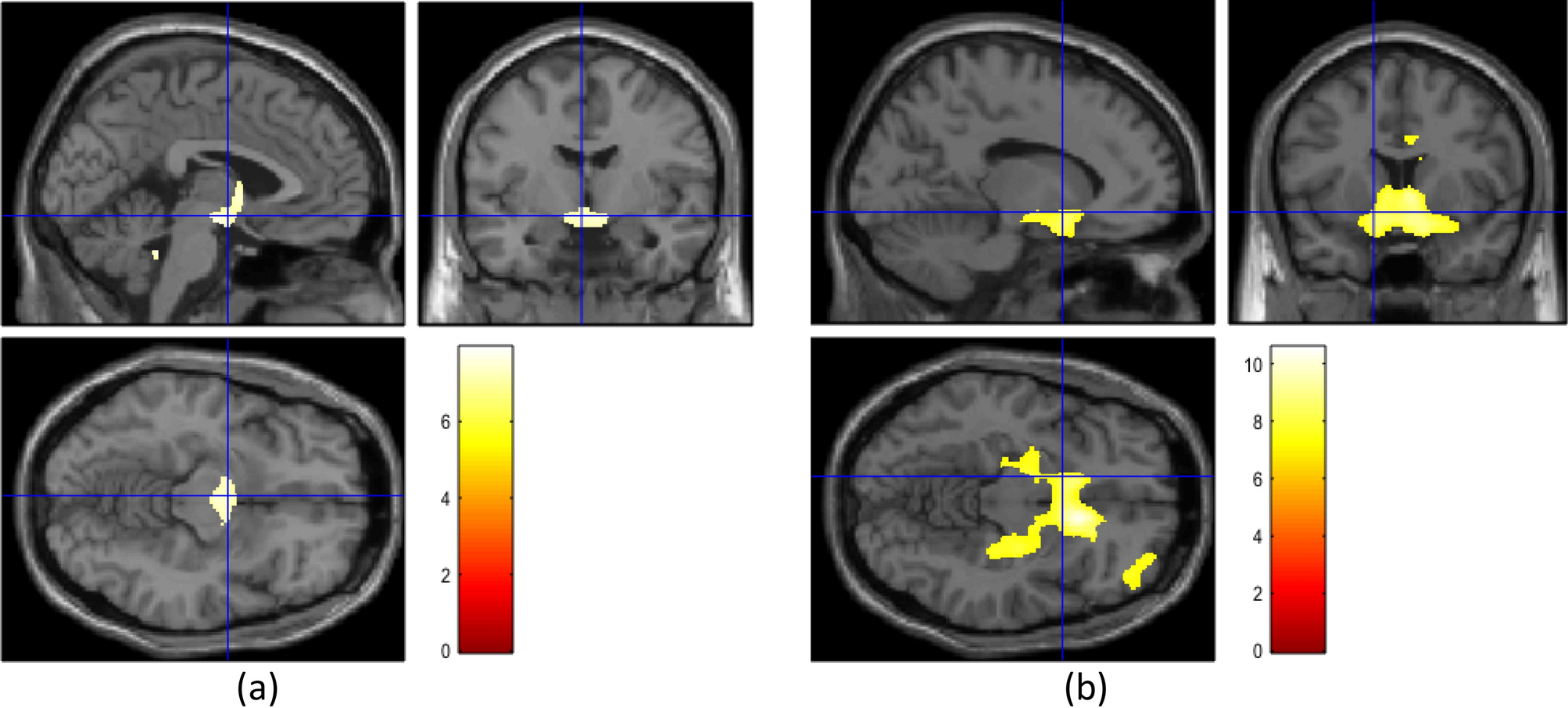 Motor Parkinson's disease and structure (Chapter 3) - Magnetic Resonance  Imaging in Movement Disorders