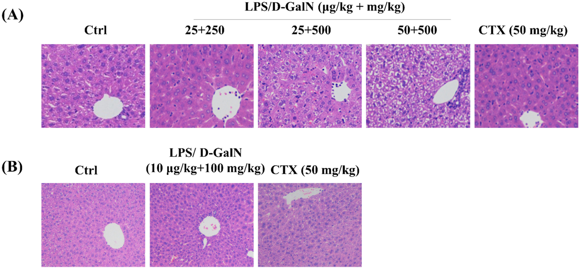 Co-administration of lipopolysaccharide and d-galactosamine induces  genotoxicity in mouse liver | Scientific Reports