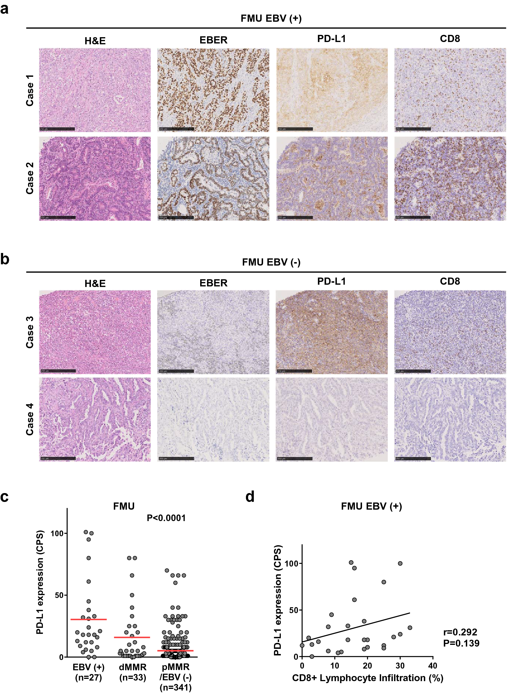 PD-L1 overexpression in EBV-positive gastric cancer is caused by unique  genomic or epigenomic mechanisms | Scientific Reports