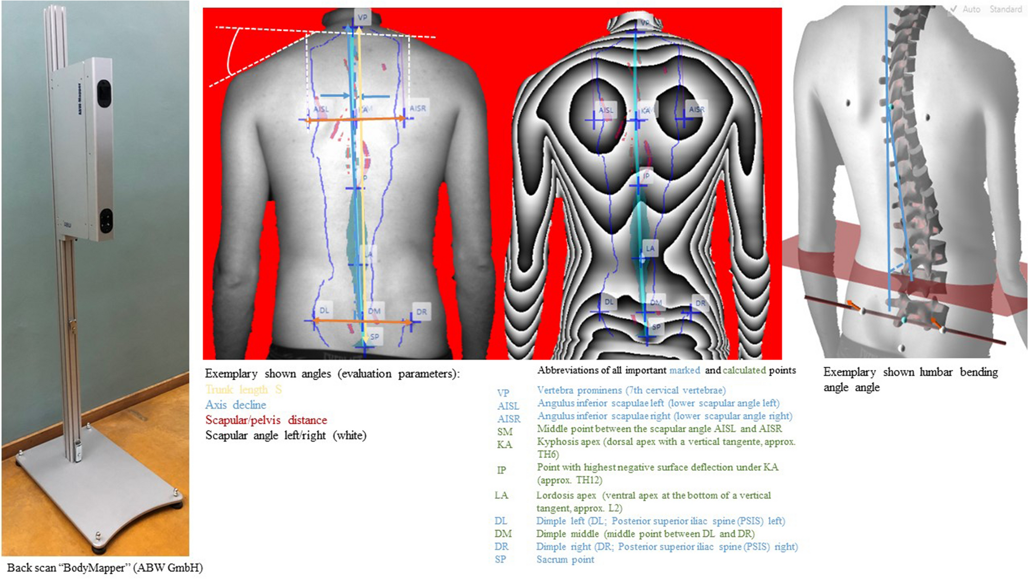 Standard reference values of the upper body posture in healthy middle-aged  female adults in Germany