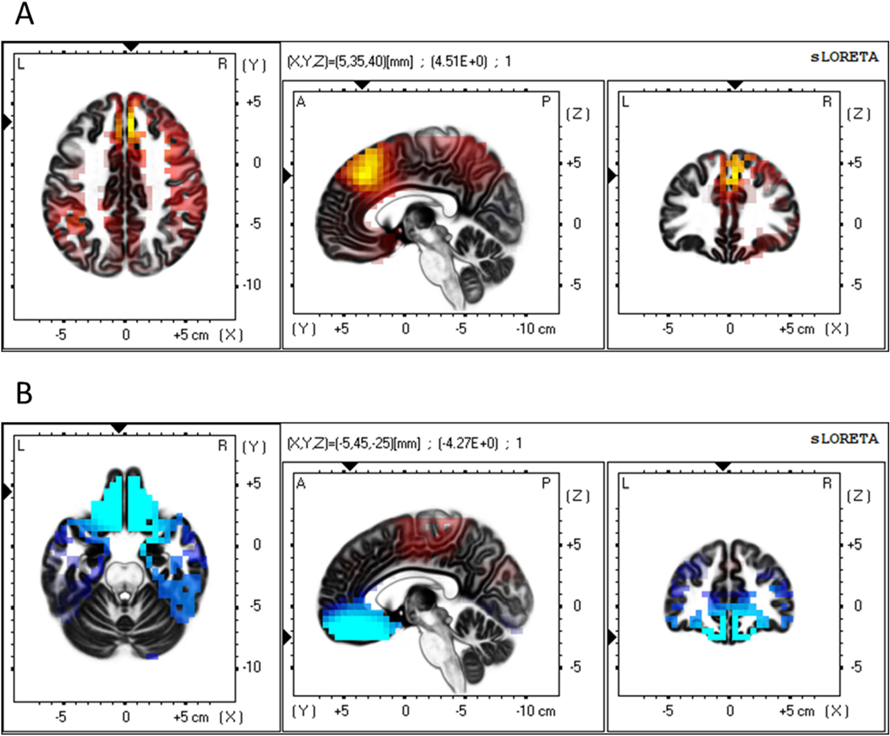 Neural Processes In Antecedent Anxiety Modulate Risk Taking Behavior Scientific Reports