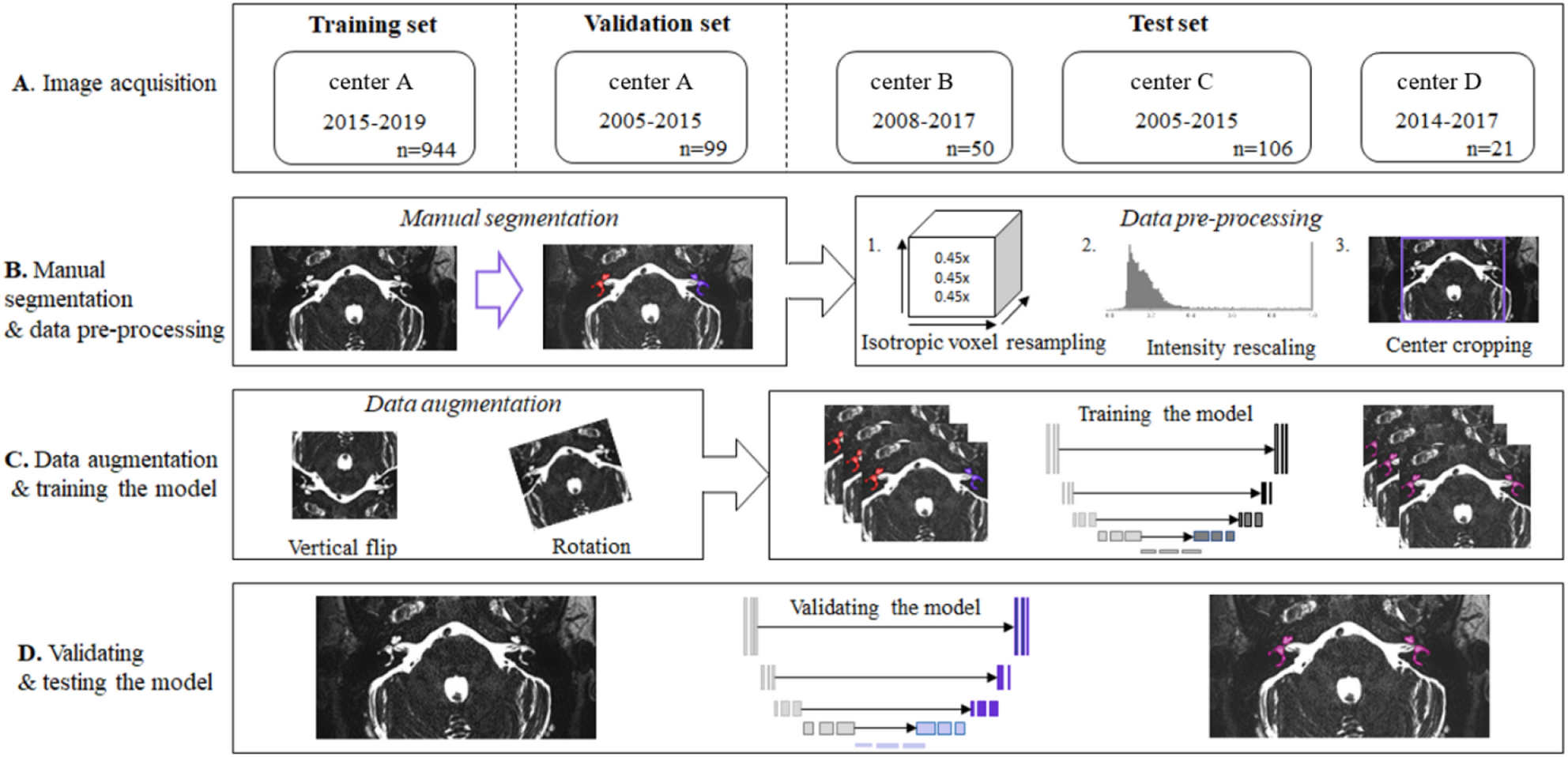 Deep learning for the fully automated segmentation of the inner ear on MRI  | Scientific Reports