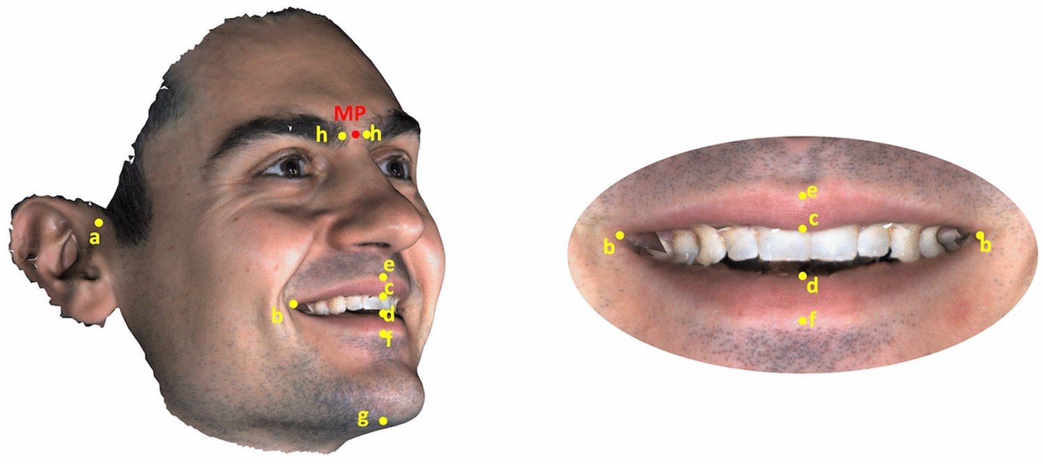 Comparison of Two Scales For Evaluation of Smile and Dental Attractiveness, PDF, Orthodontics