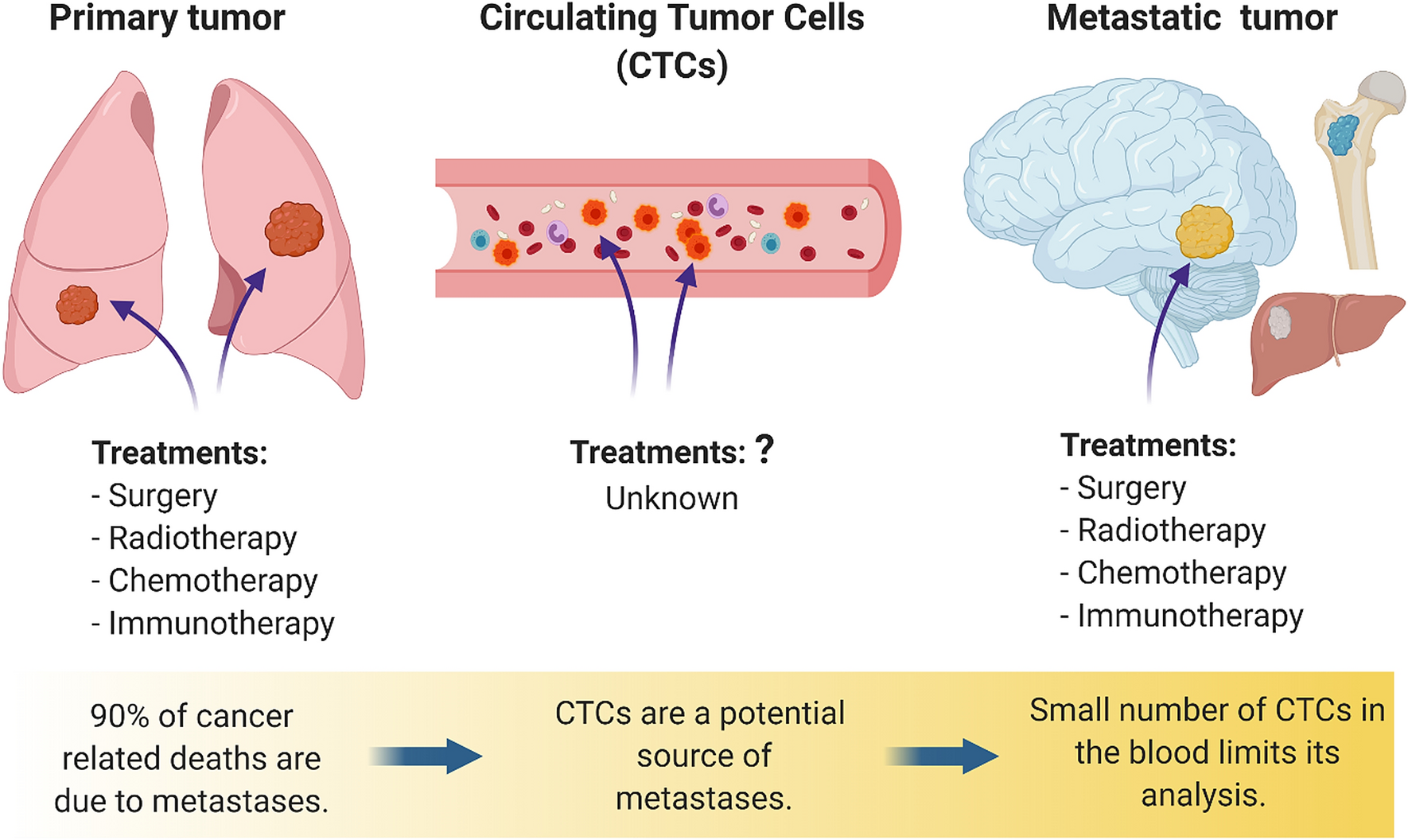 lung cancer cells diagram